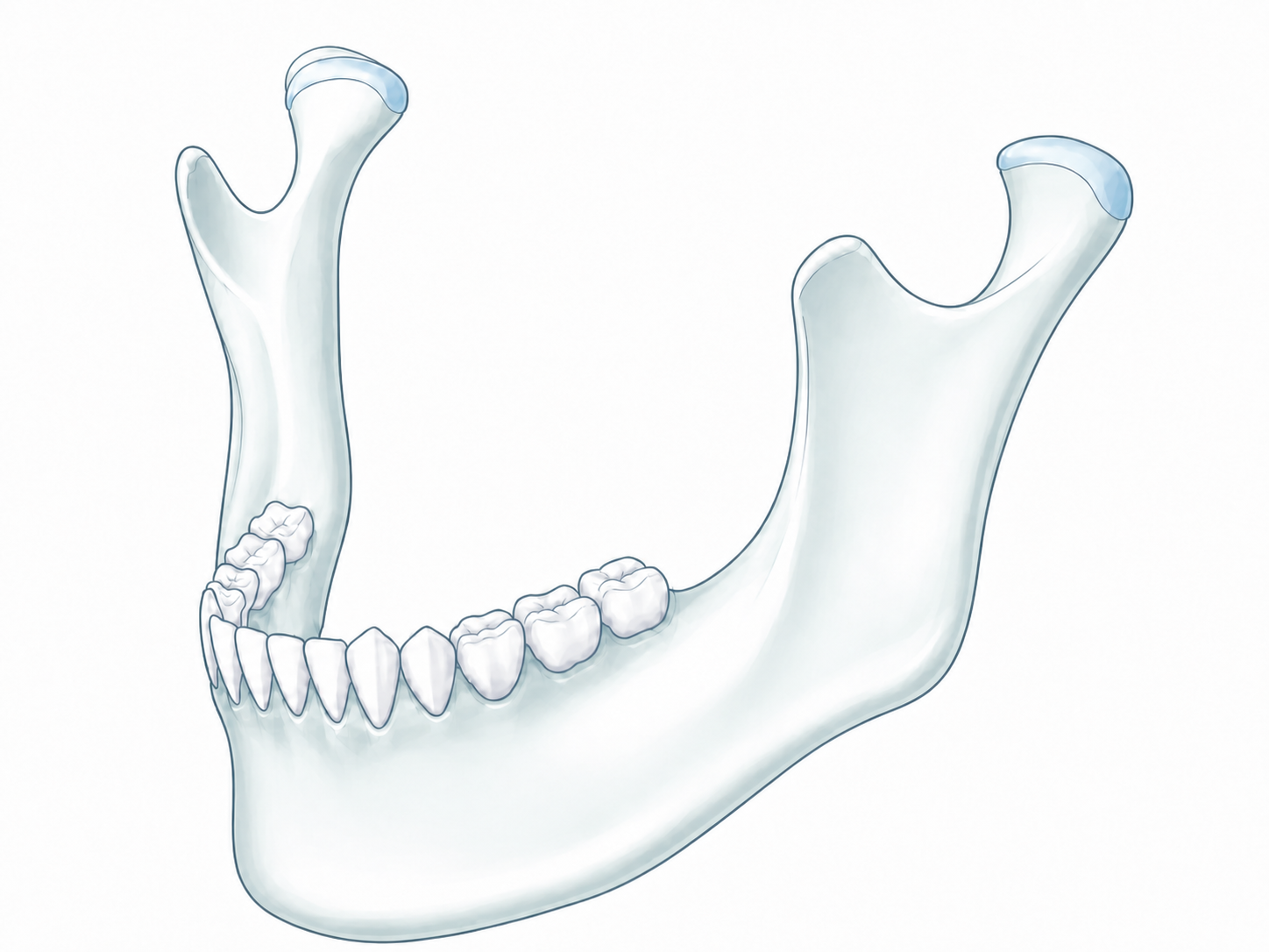 Mandibular baseline anatomy before surgical guide placement